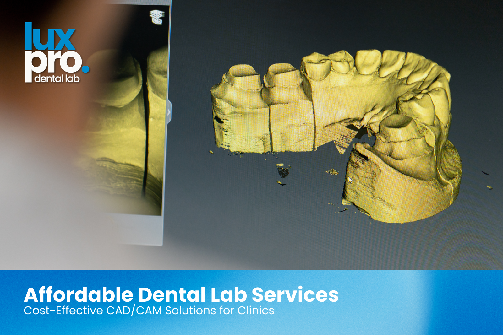 Affordable Dental Lab Services | Cost-Effective CAD/CAM Solutions for Clinics