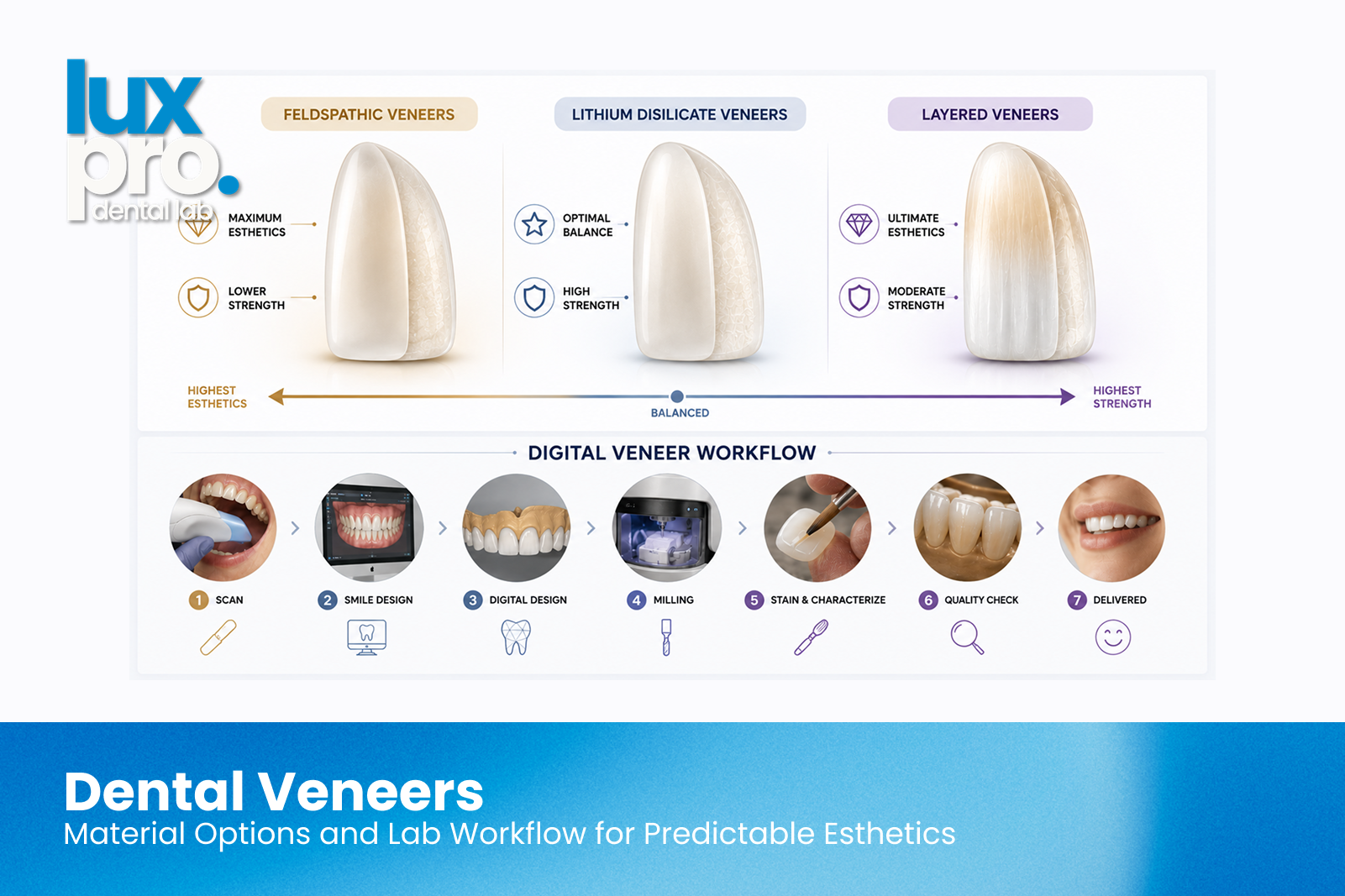 Dental veneer material options compared and the digital lab workflow from scan and smile design to fabrication.