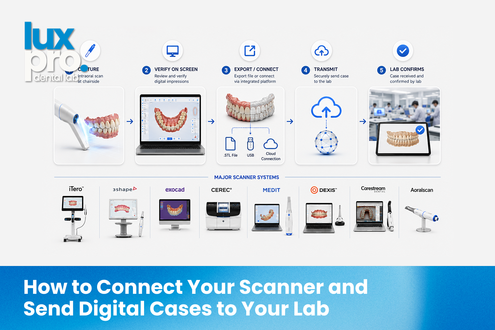 How to send digital scans to a dental lab: capture, verify, export or connect, transmit, and lab confirmation across major scanner systems