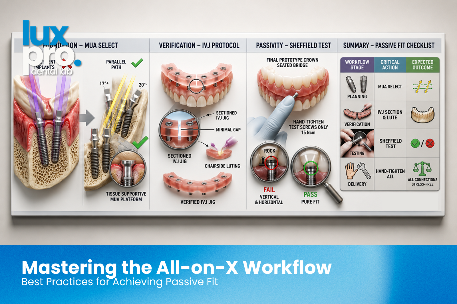 All-on-X full arch implant restoration workflow demonstrating MUA selection, verification jig testing, Sheffield test, and passive fit verification.