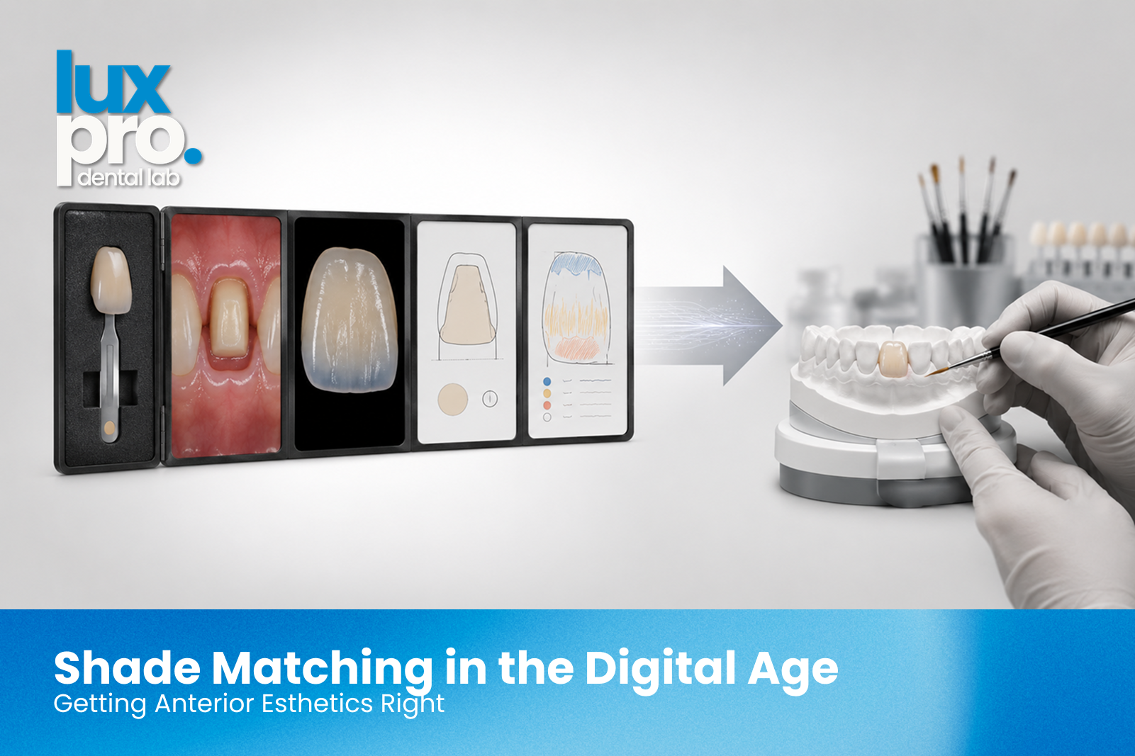 Dental shade communication elements: shade tab photography, cross-polarized image, stump shade, and characterization notes feeding the lab