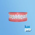 Clear Aligner Treatment Plan