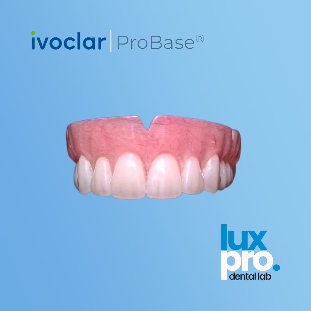 Complete Denture – ProBase® High-Impact Acrylic