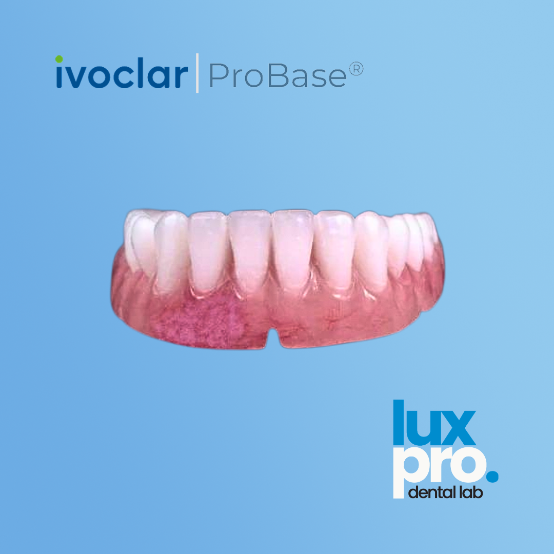 Complete Denture – ProBase® High-Impact Acrylic