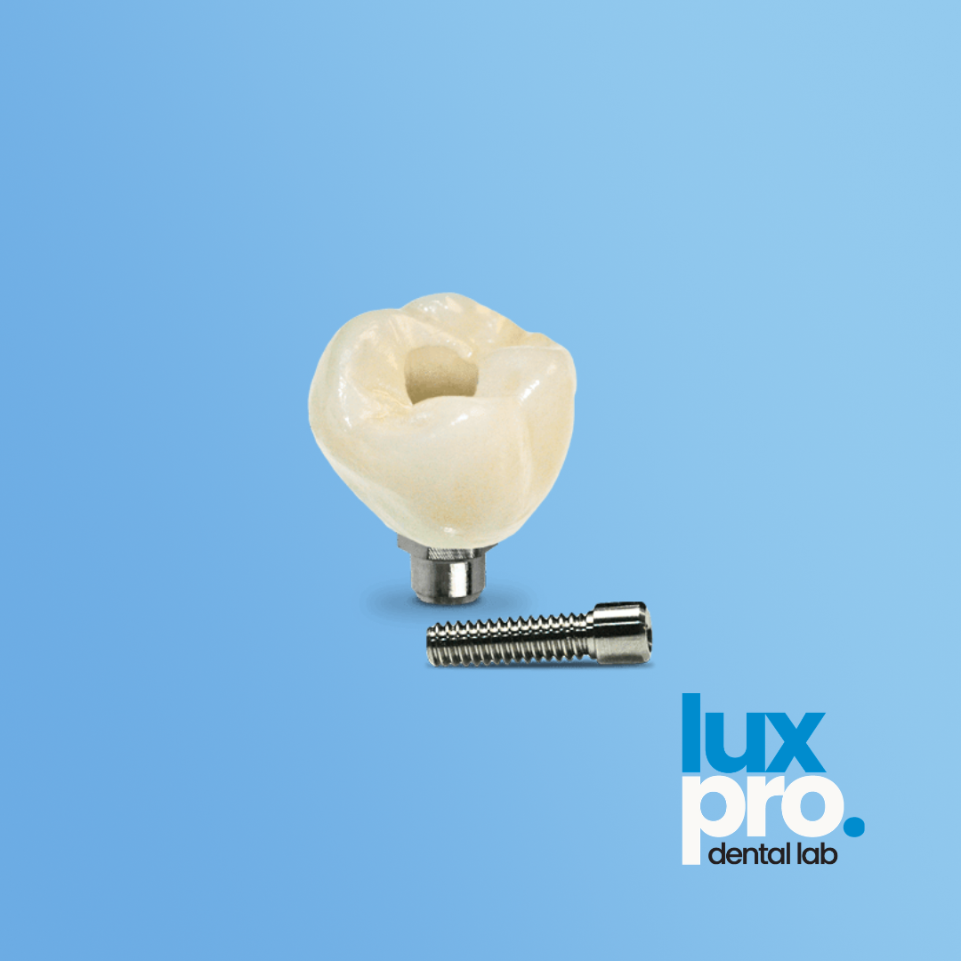 Complete Screw-Retained Implant Restoration
