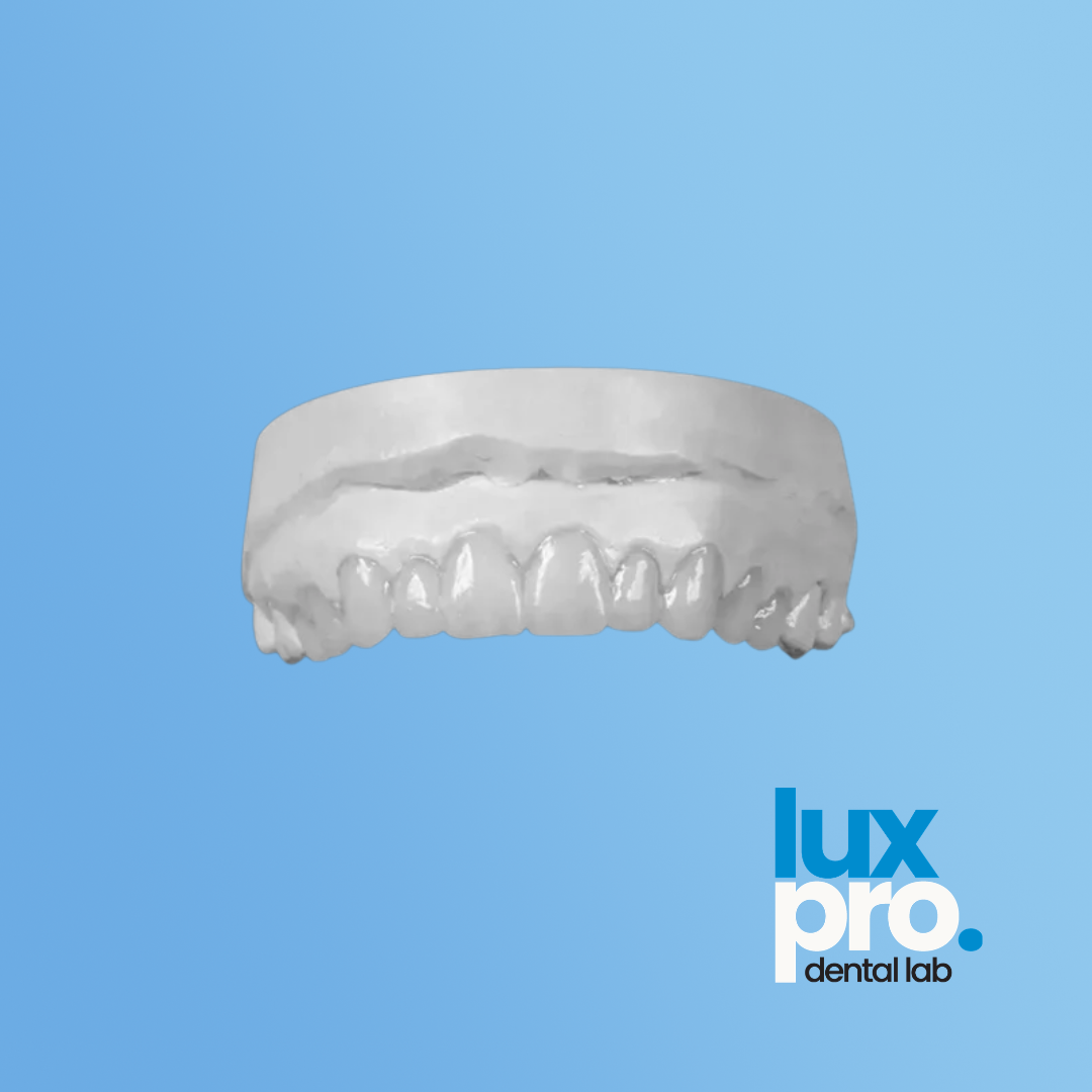 Diagnostic Wax-Up