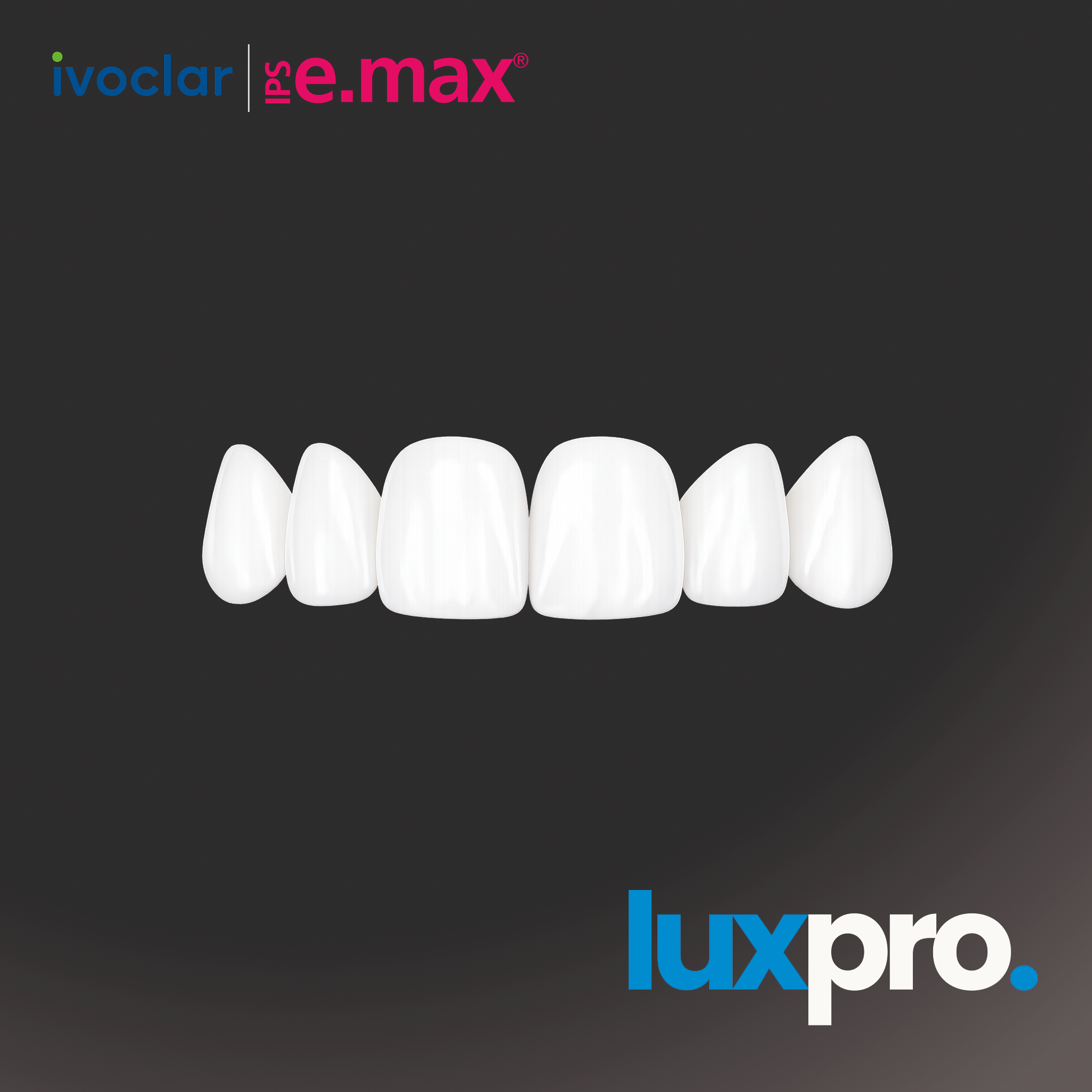 IPS e.max Veneers