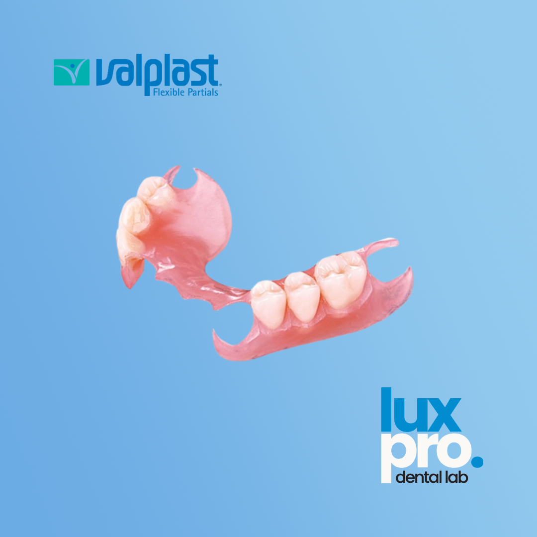 Flexible Nylon Partial Denture