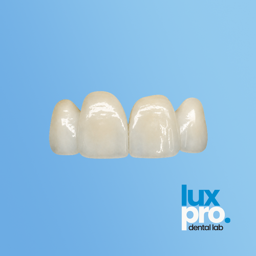Layered Zirconia