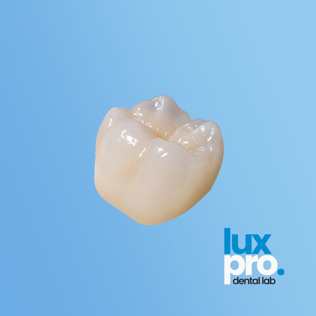 Layered Zirconia Crowns