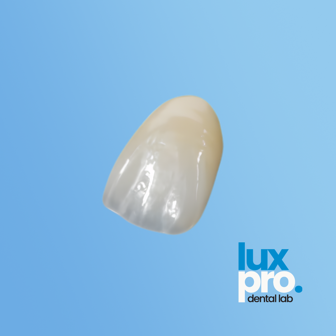 Layered Zirconia Crowns