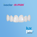IPS e.max Crowns®