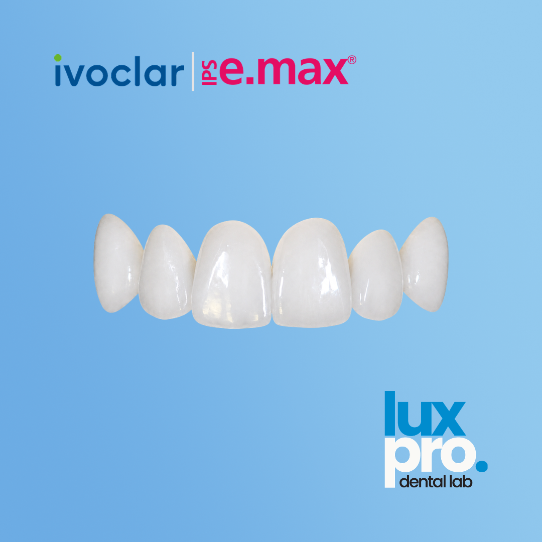 IPS e.max Crowns®
