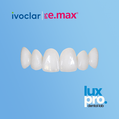 IPS e.max®