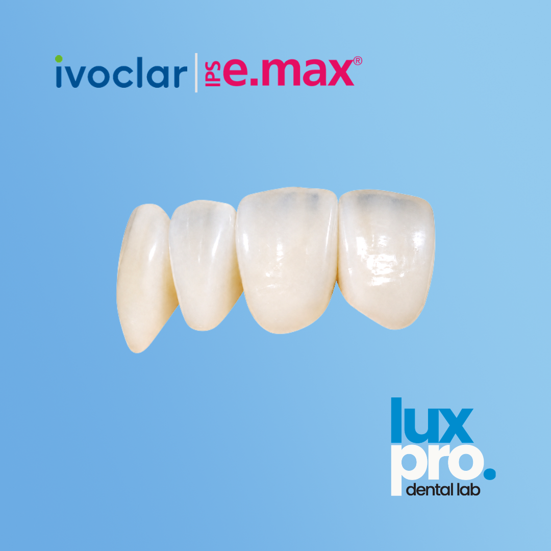 IPS e.max Crowns®