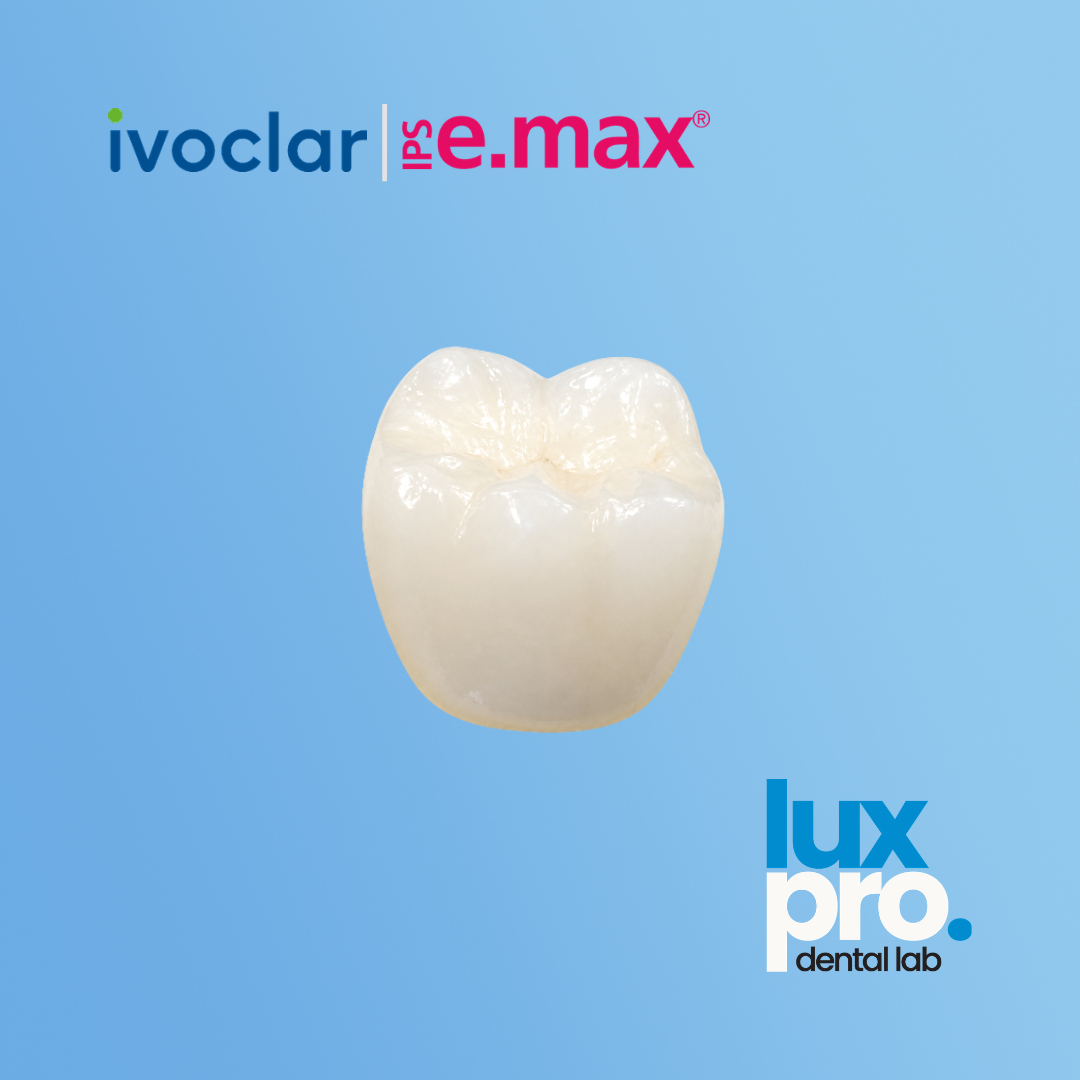 IPS e.max Crowns®