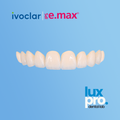 IPS e.max Veneers