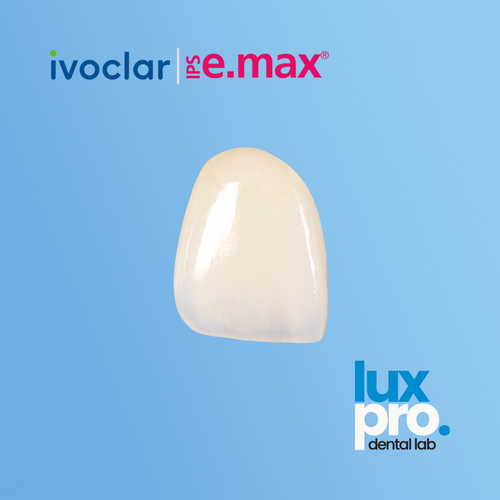 IPS e.max Veneer