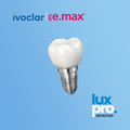 IPS e.max Over Implants