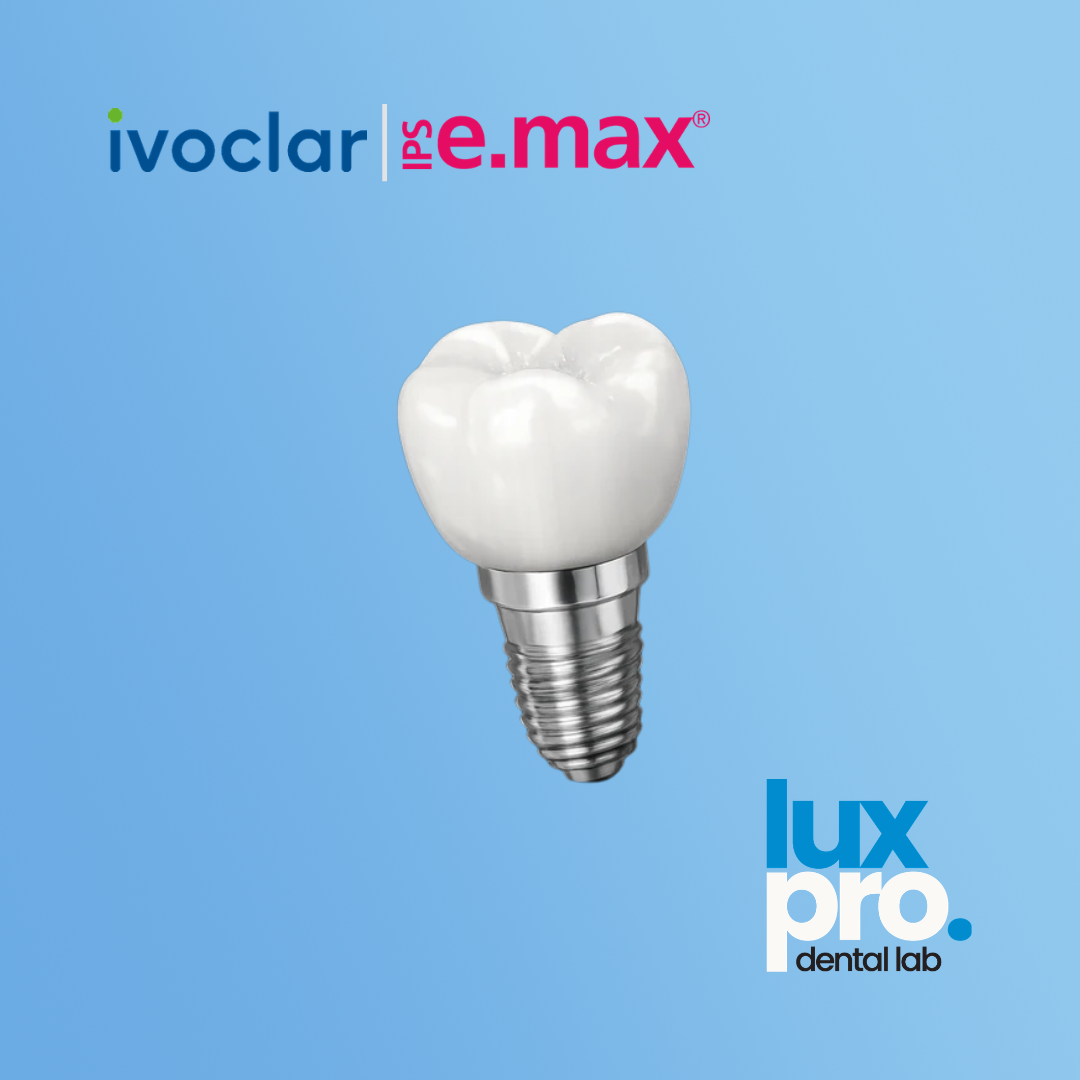 IPS e.max Over Implants