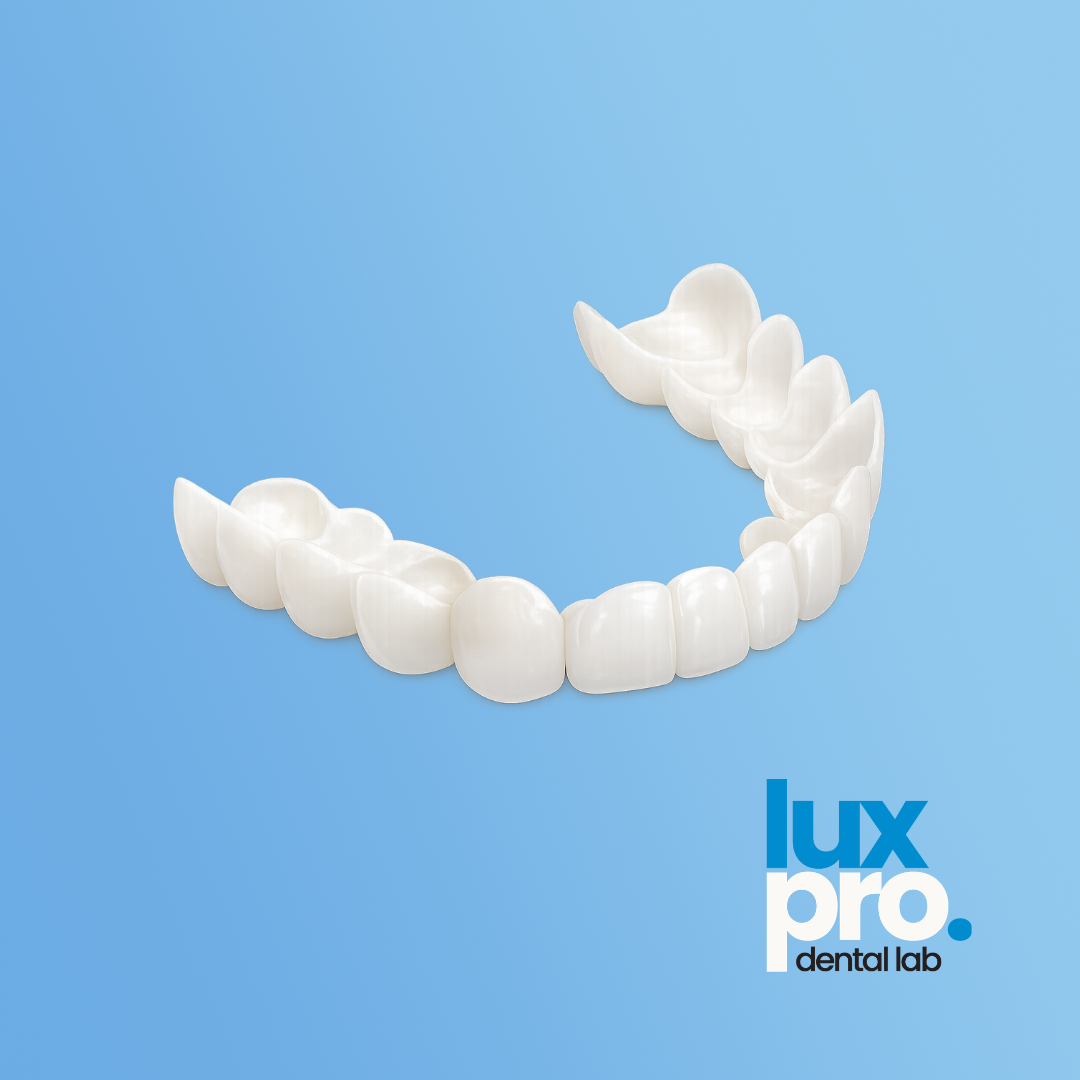 Removable Cosmetic Overlay Appliance