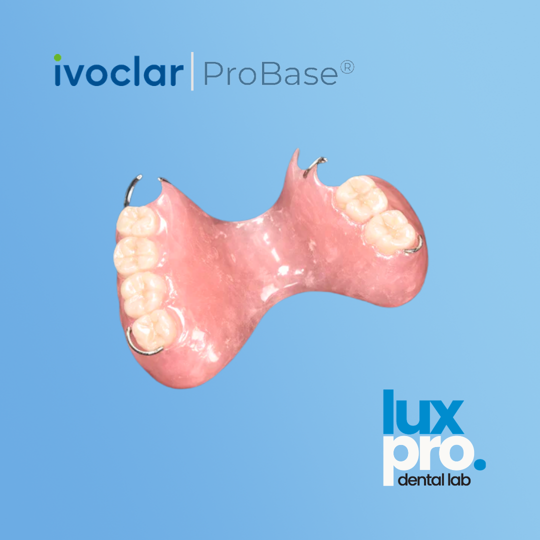 Removable Partial Denture (RPD) – ProBase® Acrylic Base