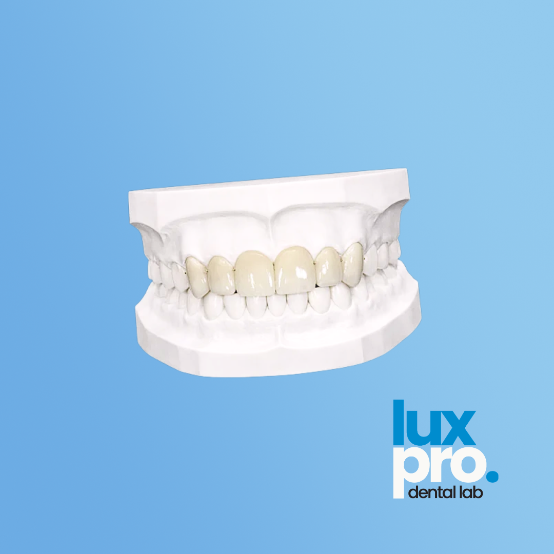 Temporary Full-Arch Teeth (PMMA)
