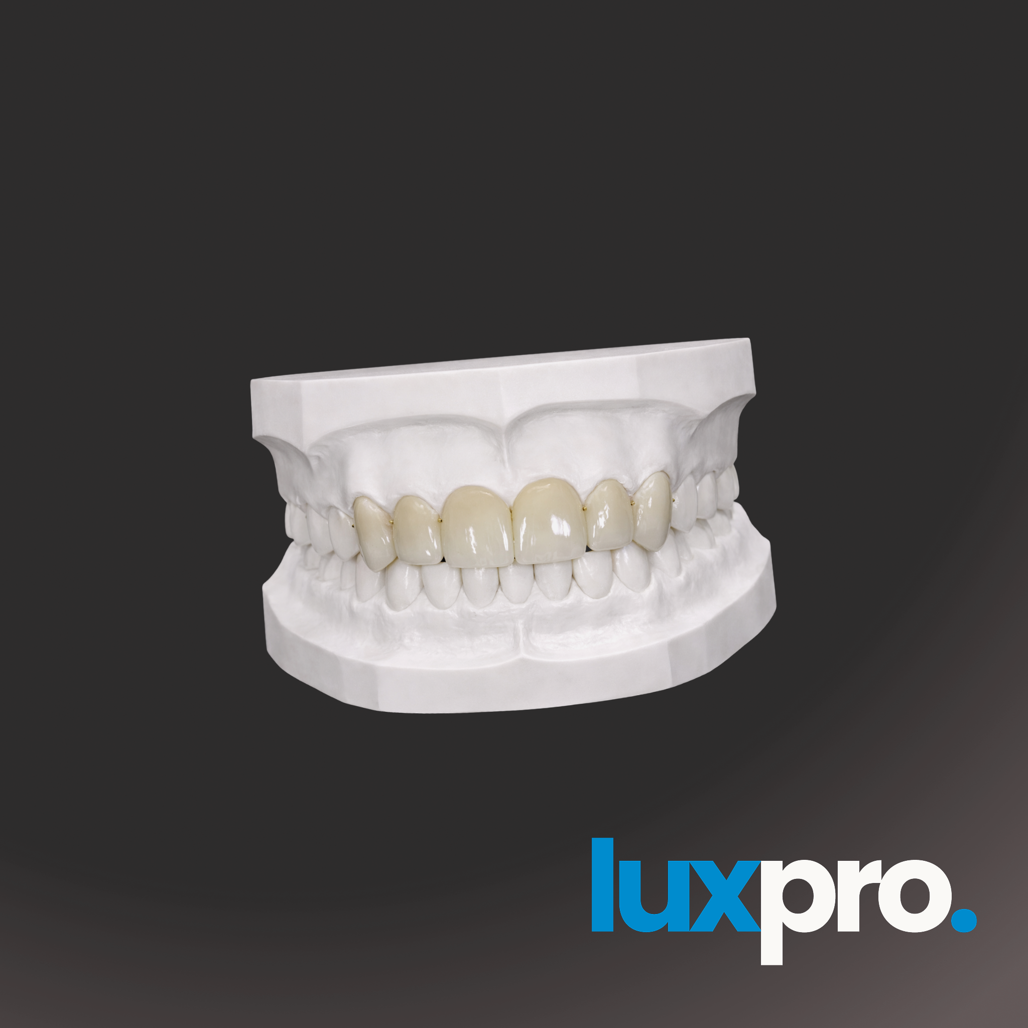 Temporary Full-Arch Teeth (PMMA)
